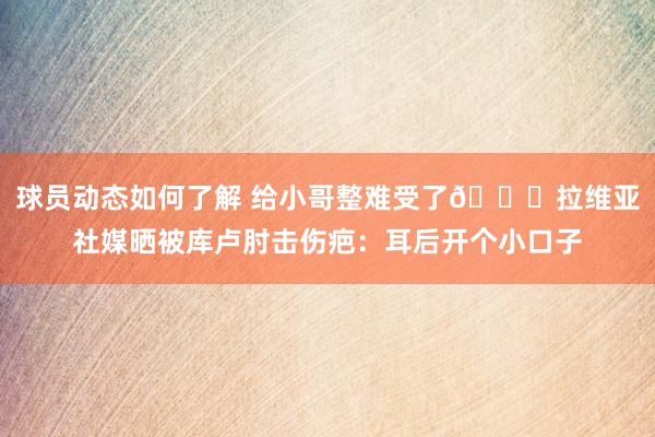 球员动态如何了解 给小哥整难受了😅拉维亚社媒晒被库卢肘击伤疤：耳后开个小口子