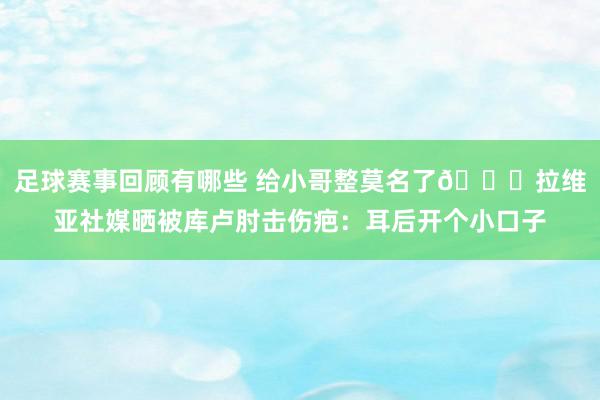 足球赛事回顾有哪些 给小哥整莫名了😅拉维亚社媒晒被库卢肘击伤疤：耳后开个小口子